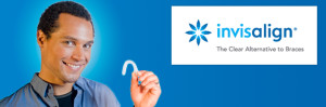 invisalign experience