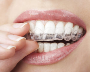 masks and braces