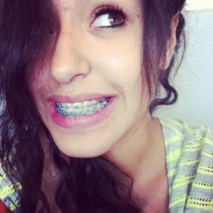 colored-braces