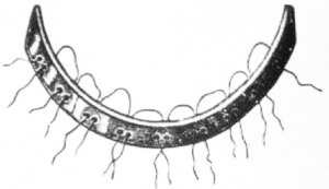 illustration of a bandeau orthodontic device