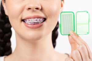 Girl with dental wax on braces