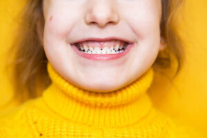 Kid with underbite, yellow sweater, close-up
